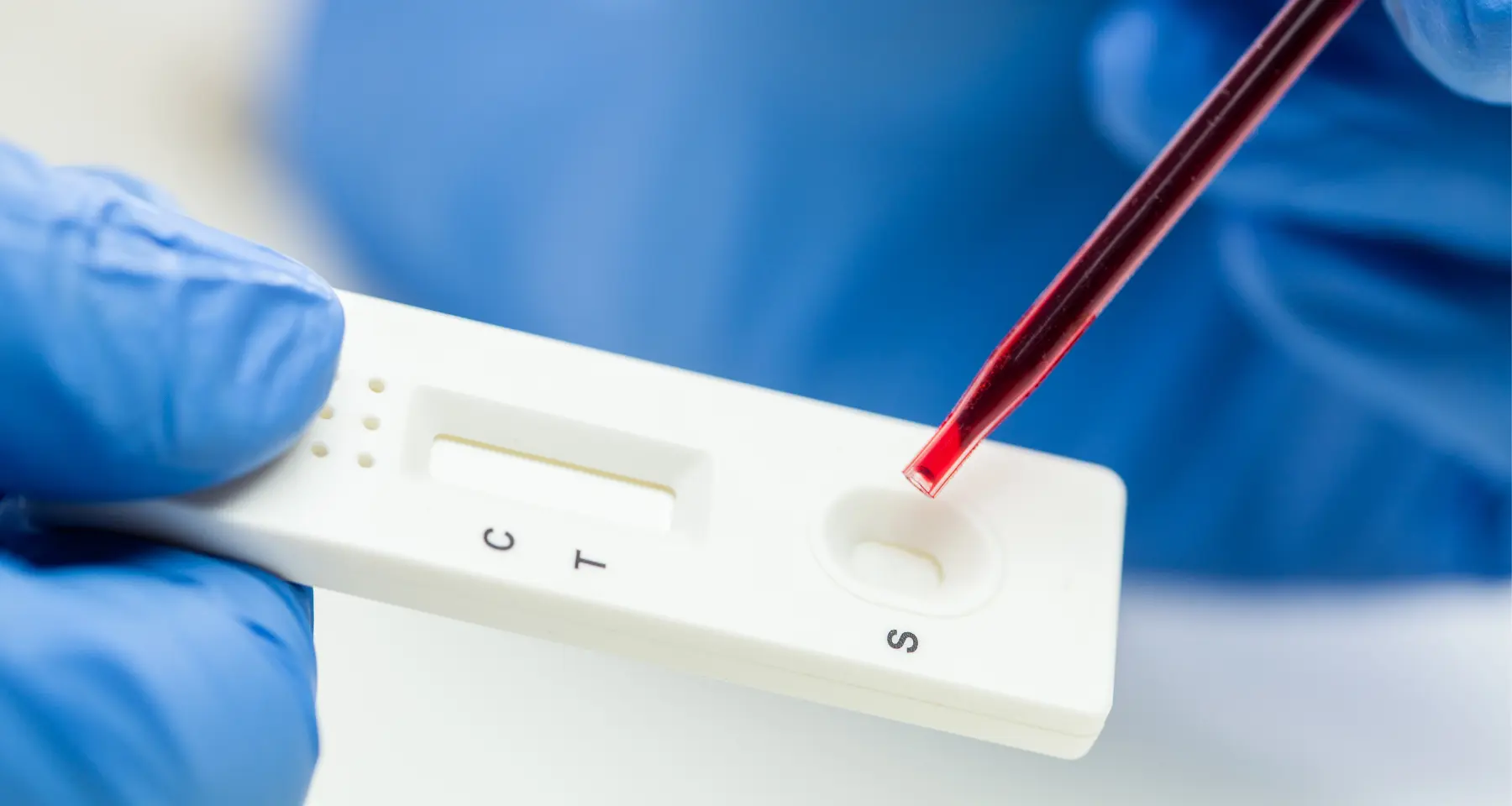 Membranes for Rapid Test Diagnostics